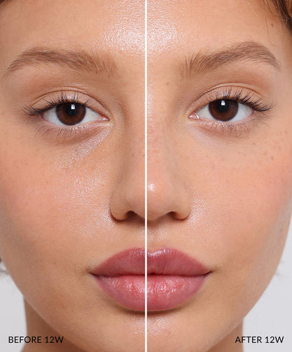Concealer